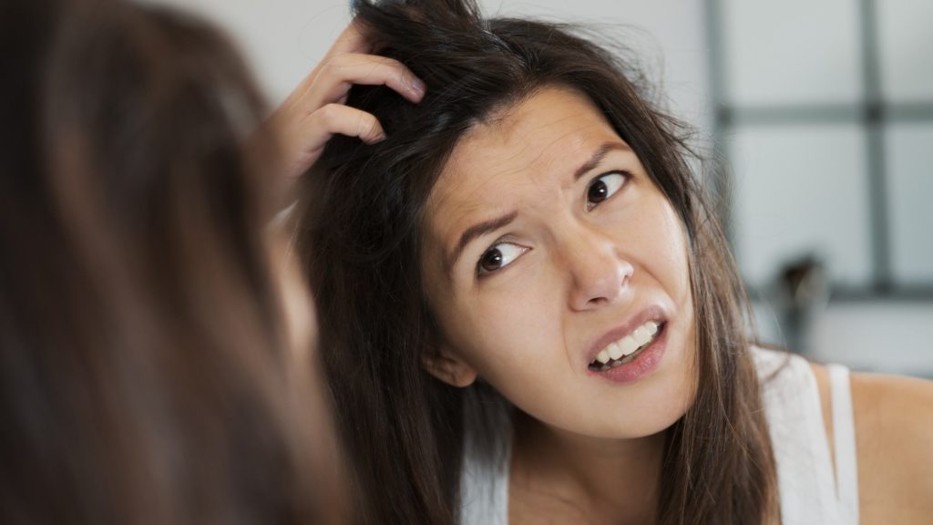 how to avoid dandruff